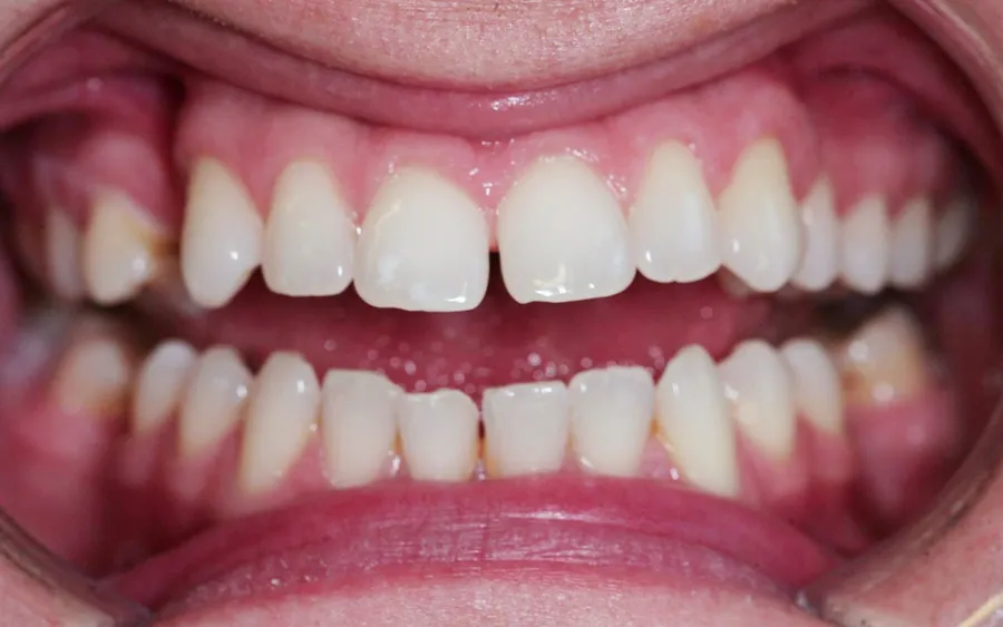 Before treatment