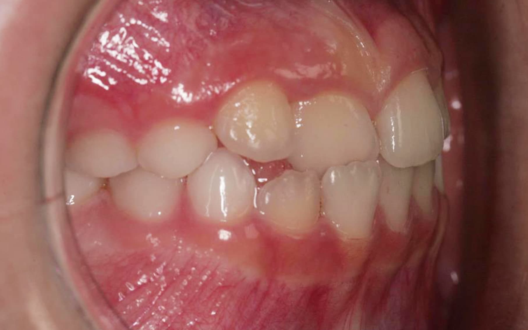 Przed leczeniem