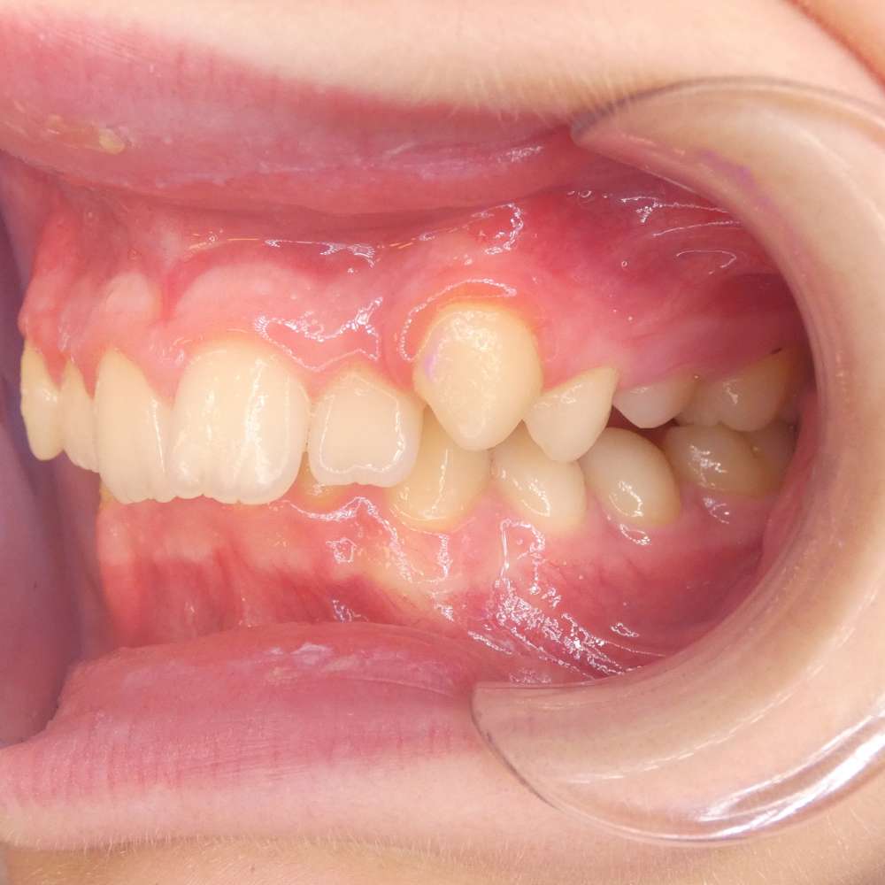 Obraz przed leczeniem