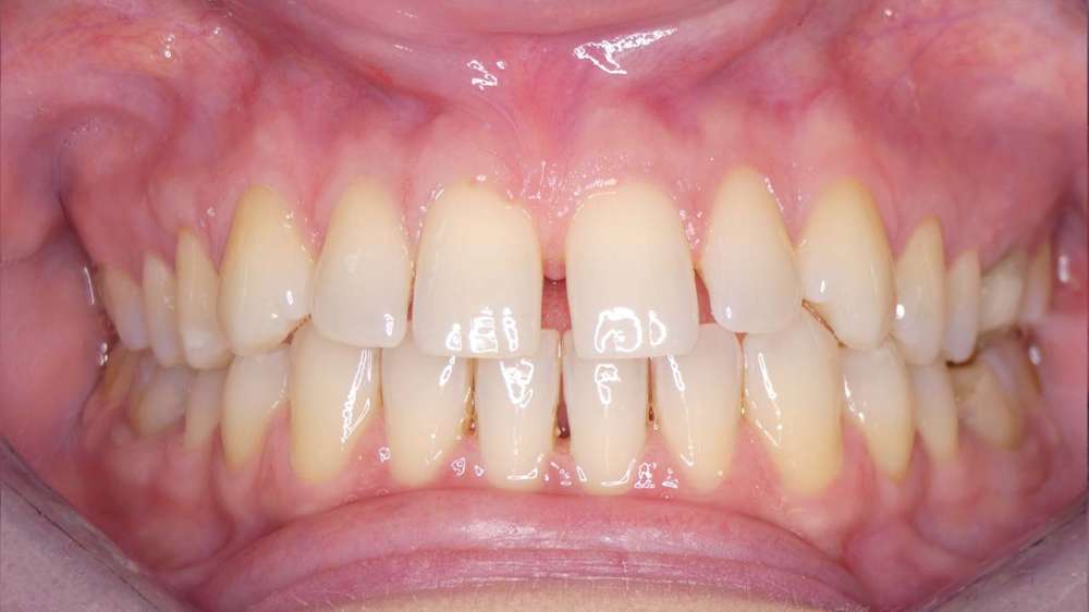 Obraz przed leczeniem