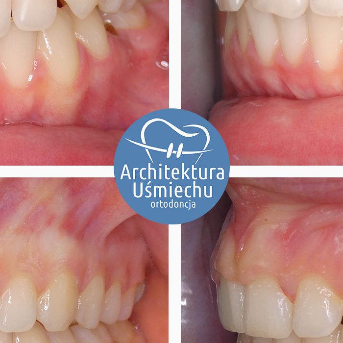 Standard Post with Image